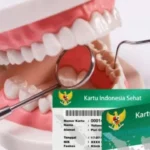 Memahami Layanan Perawatan Gigi yang Ditanggung oleh BPJS Rincian, Persyaratan, dan Manfaatnya