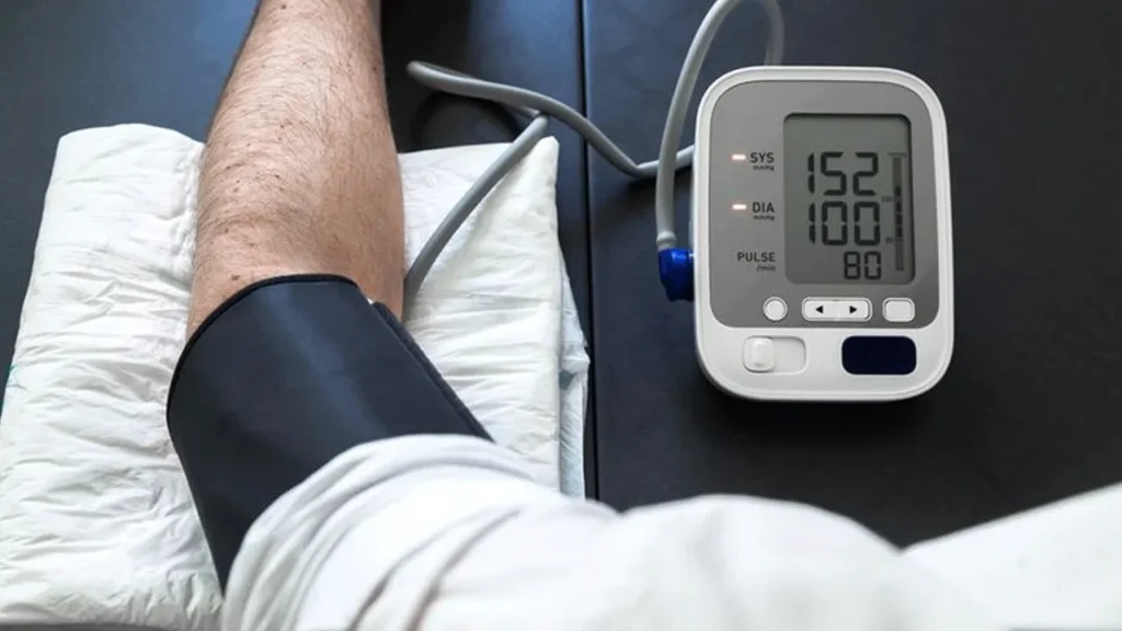 Awas! Hipertensi Bisa Bikin Aneurisma Otak Meledak, Simak Penjelasan Dokter.