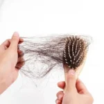 Nggak Ada Rontok-Rontoknya: Rahasia Menghadapi Masalah Rambut Rontok dengan Vitamin!