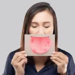 Sariawan? Santai Saja, Ini Cara Mengatasinya!